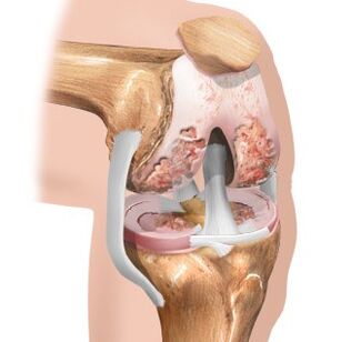 Vêtements de cartilage